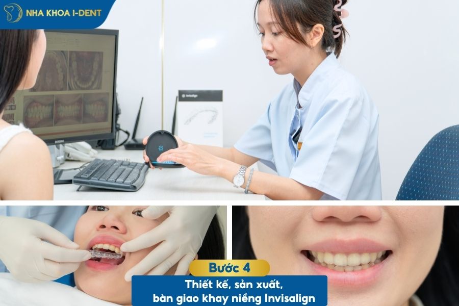 quy trình niềng khay invisalign