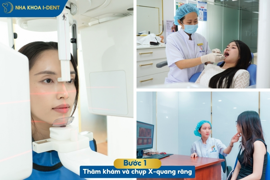 quy trình niềng răng trong suốt invisalign