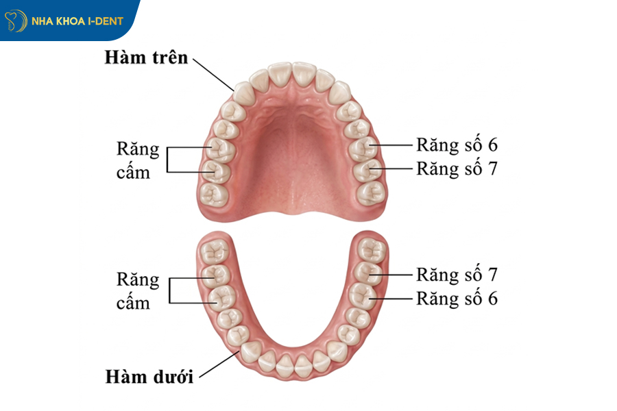 Răng cấm có trồng được không