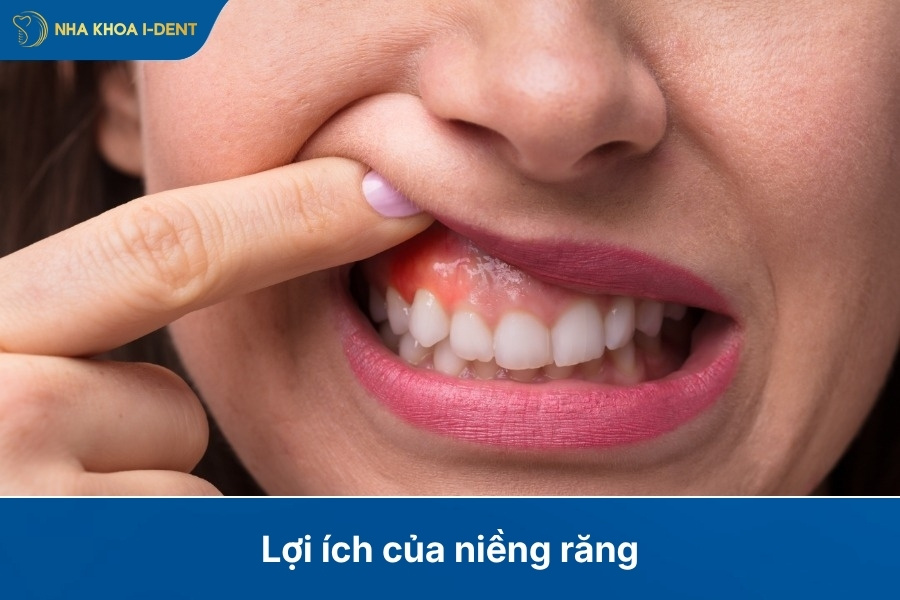 tác dụng của việc niềng răng