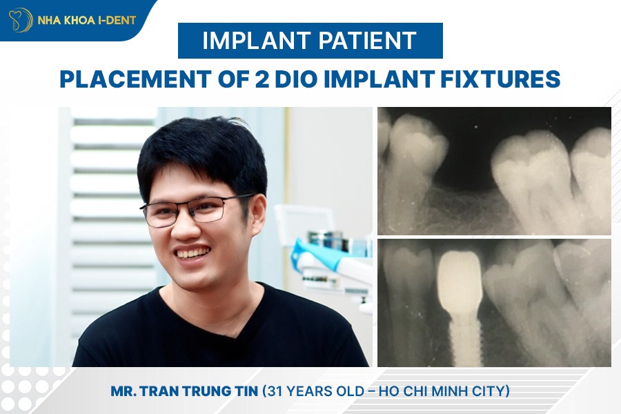 dental implants cost