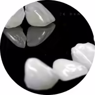 veneer teeth