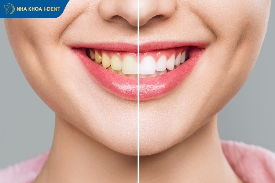 crown teeth price