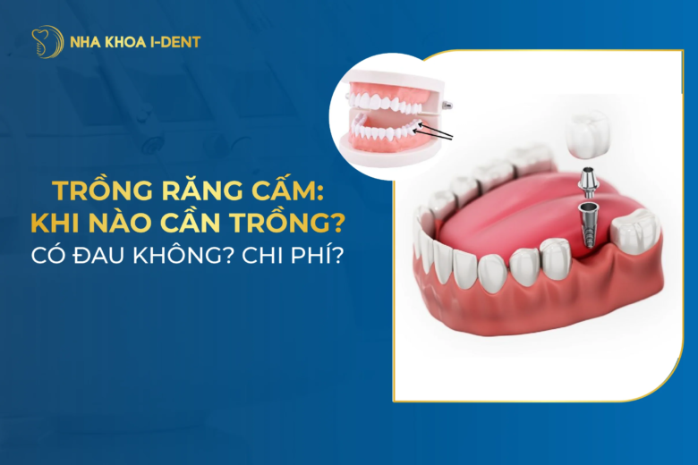 Trồng răng cấm: Khi nào cần trồng? Có đau không? Chi phí?