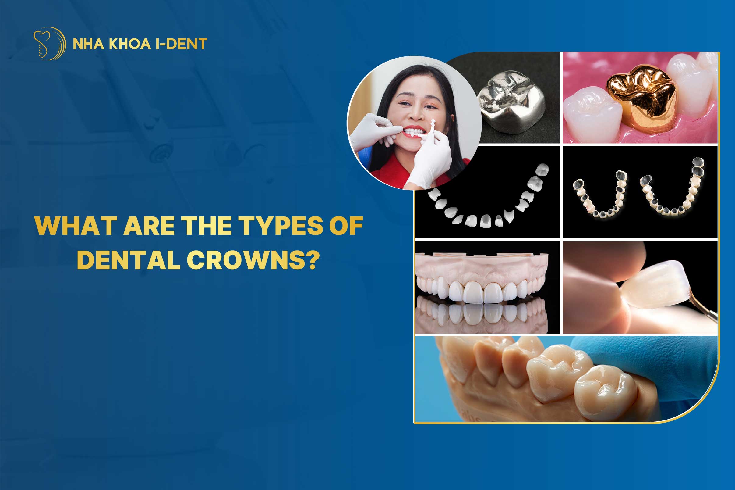 Types of Dental Crowns and Cost: Which One Suits You?