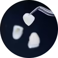 teeth veneers