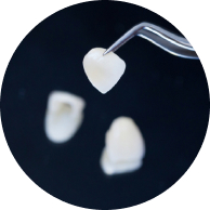 teeth veneers