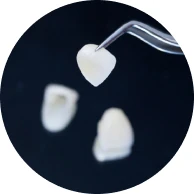 teeth veneers