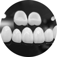 tooth veneers