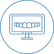 dental veneers