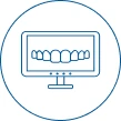 dental veneers