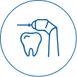 dental veneers