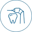dental veneers