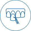 dental veneers