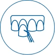 dental veneers