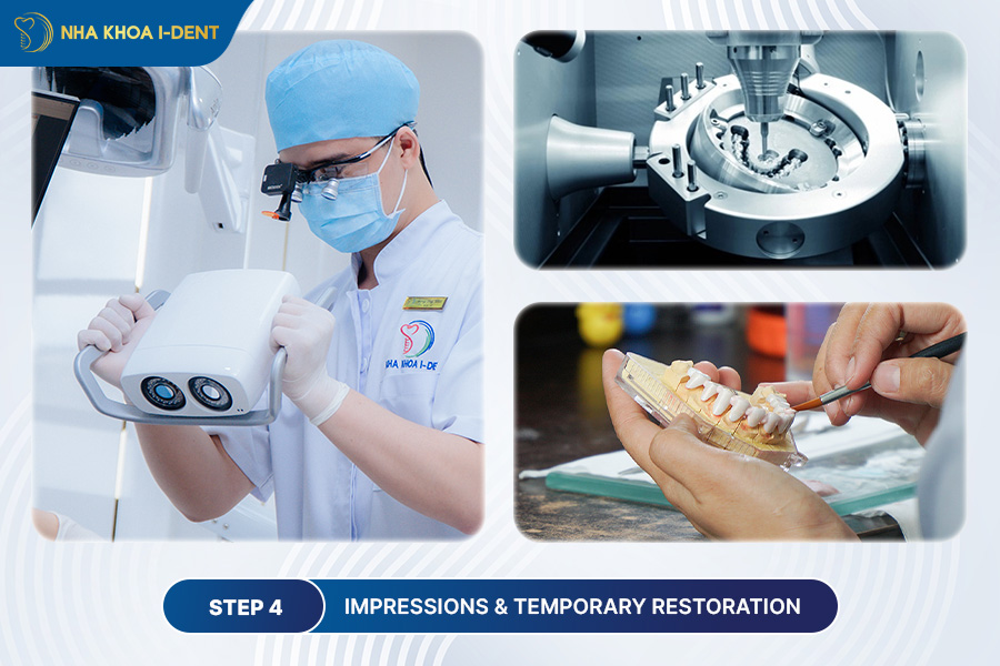 what is dental implants procedure