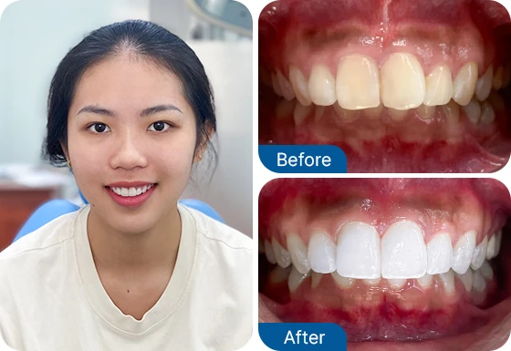 Ms. Nguyen Huu
