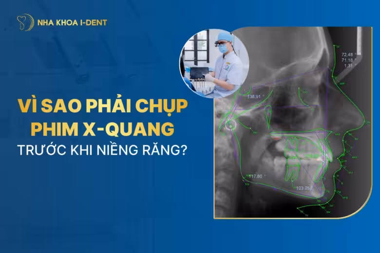 Tại sao phải chụp phim X-quang trước khi niềng răng?