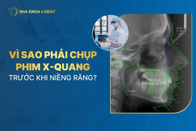 Tại sao phải chụp phim X-quang trước khi niềng răng?