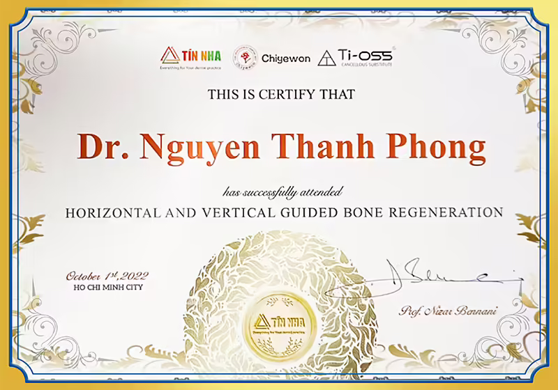 Horizontal and vertical guided bone regenration BS Phong