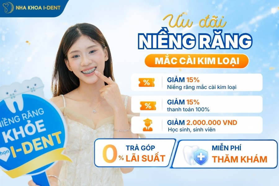 niềng răng mắc cài kim loại