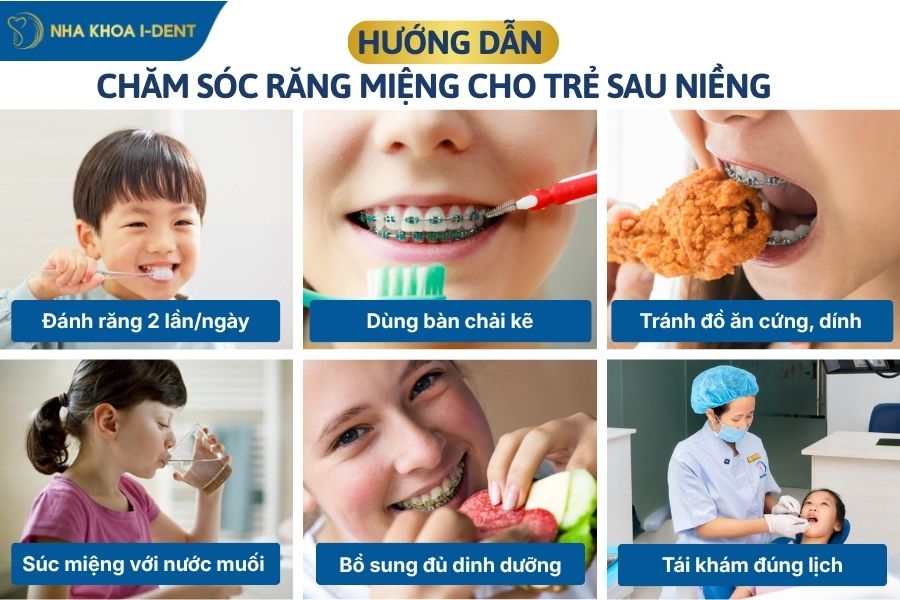 chăm sóc răng miệng cho trẻ khi niềng