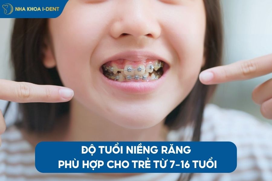niềng răng cho trẻ em