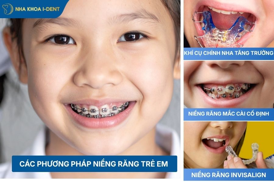 niềng răng cho trẻ