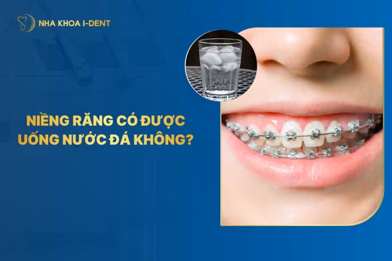 Đang niềng răng có được uống nước đá không? Tác hại gì?