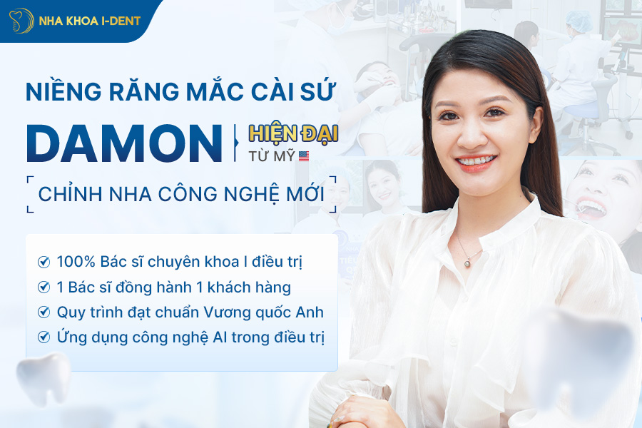 niềng răng mắc cài sứ