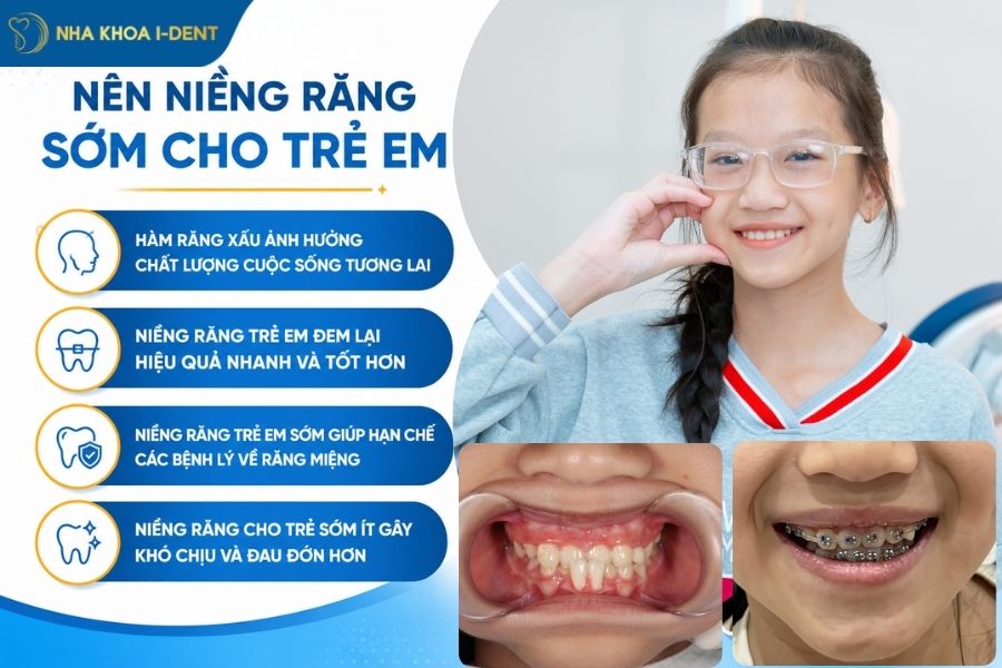 niềng răng trẻ em