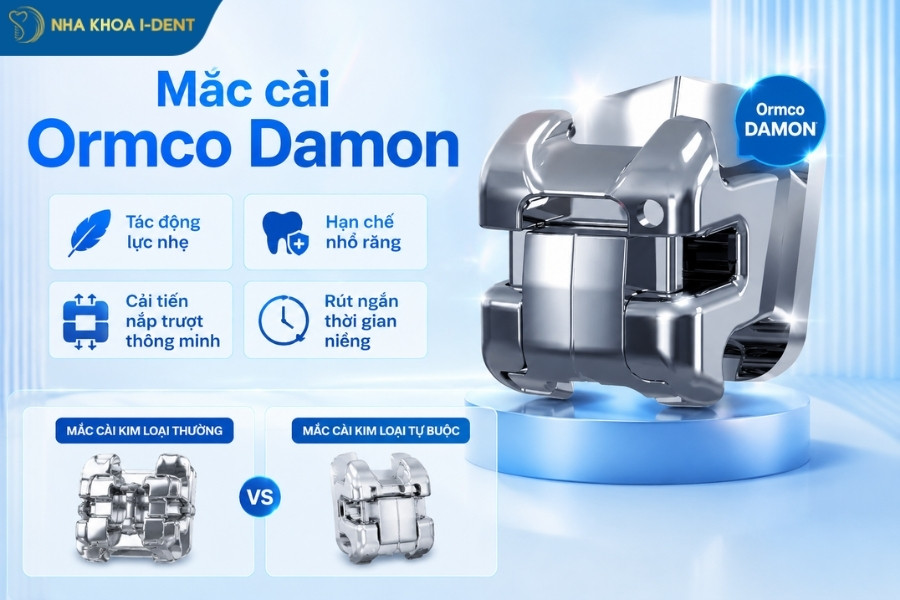 mắc cài kim loại damon