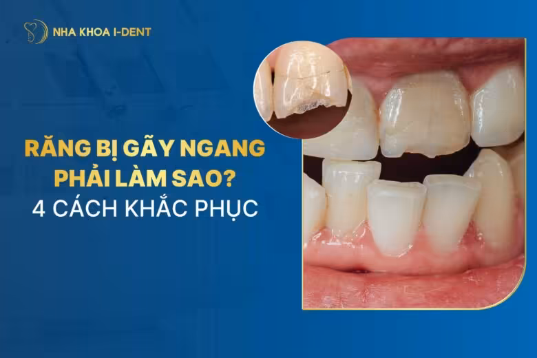 Răng bị gãy ngang phải làm sao? Cách xử lý và khắc phục