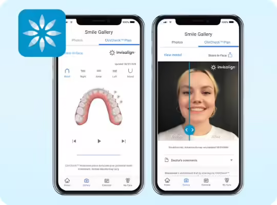 App theo dõi chỉnh nha thông minh
