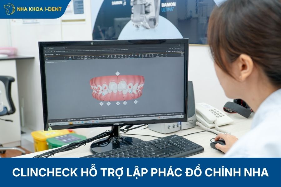 clincheck invisalign là gì