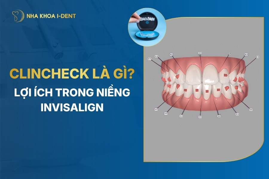clincheck