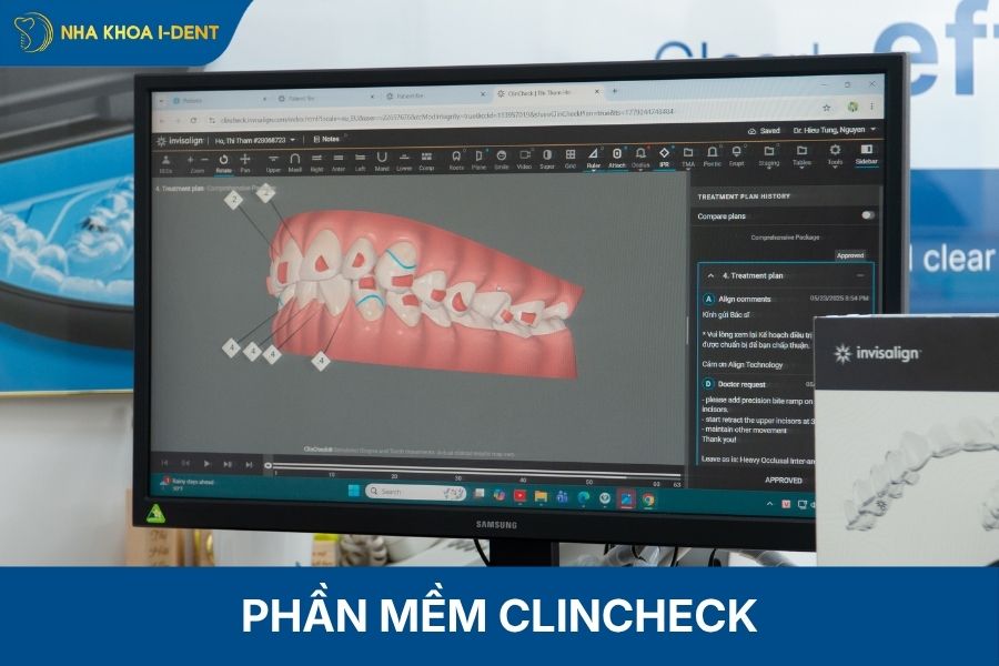 clincheck là gì