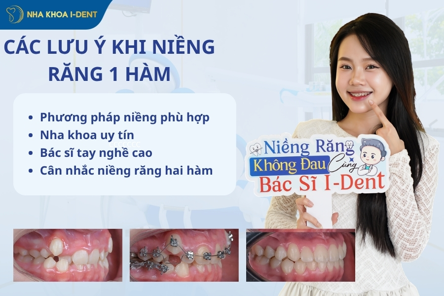 niềng răng 1 hàm được không