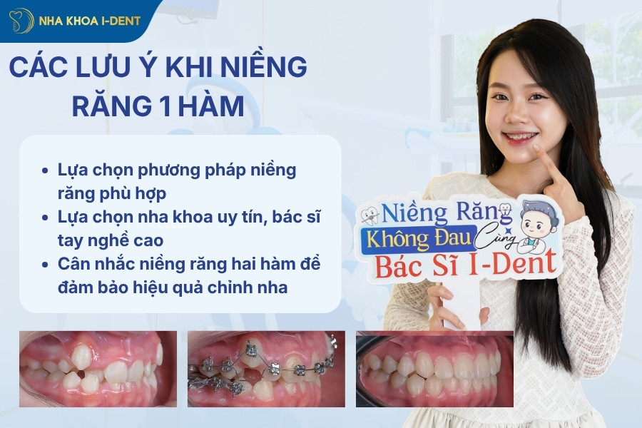 có niềng răng 1 hàm được không