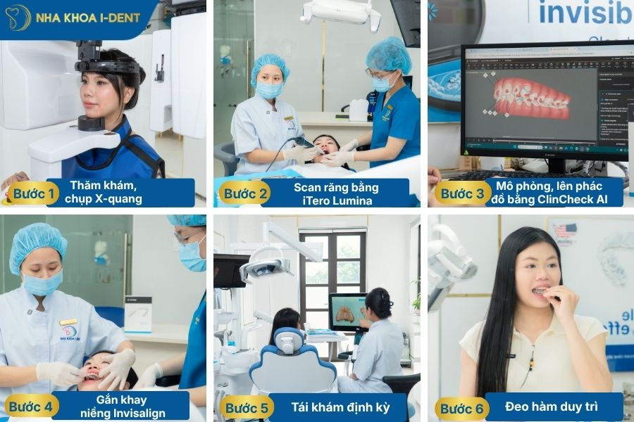 quy trình gắn attachment