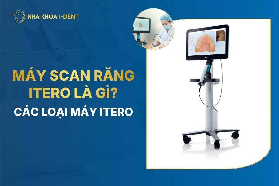 máy scan itero