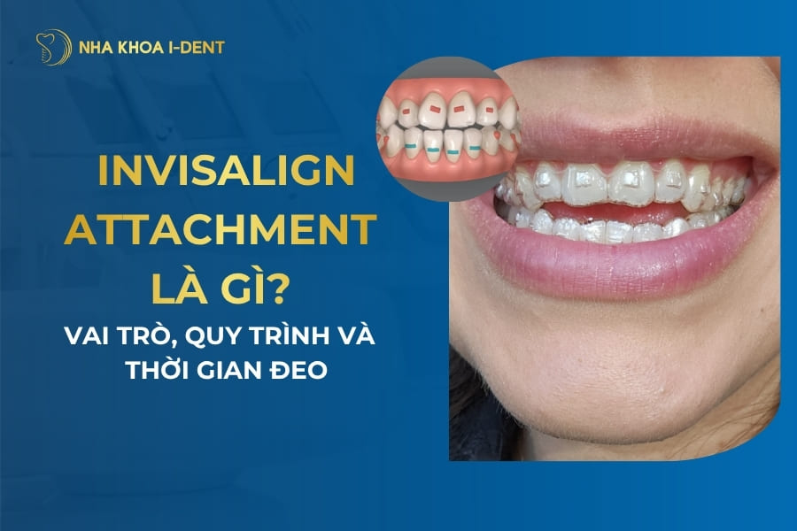 invisalign attachments
