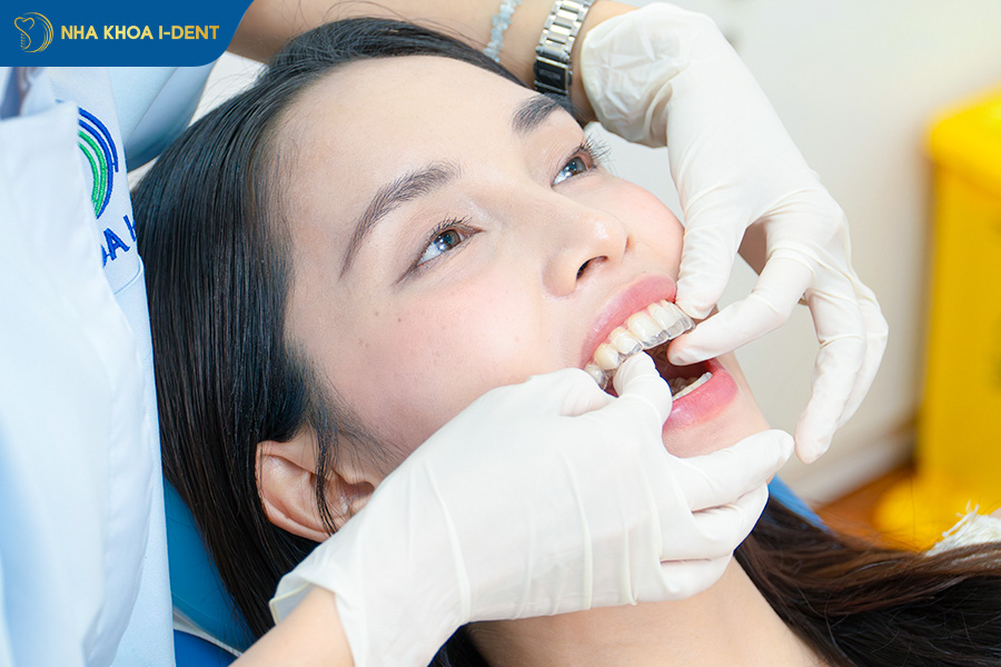 invisalign smarttrack