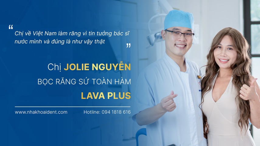 Jolie Nguyễn - Khách hàng răng sứ