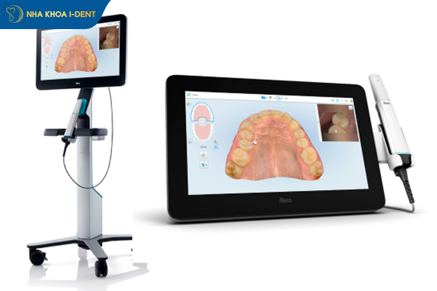 máy scan itero