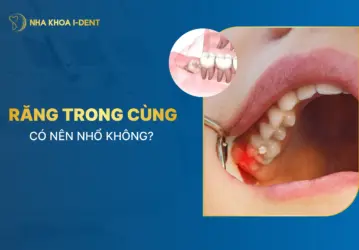 nhổ răng cùng