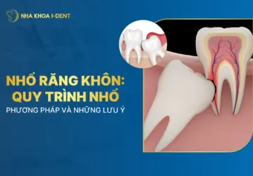 nhổ răng khôn