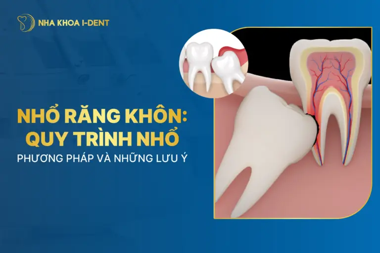 nhổ răng khôn