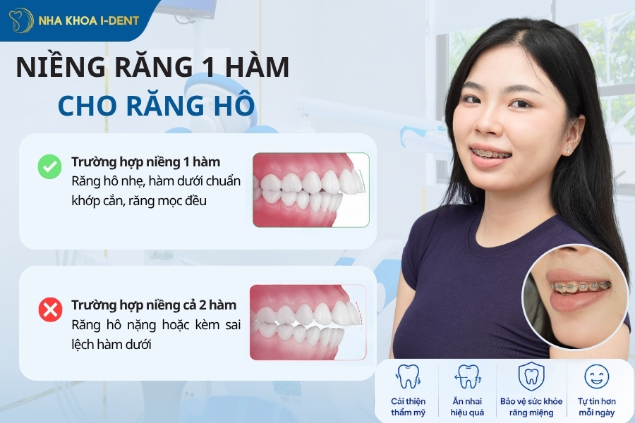 niềng răng 1 hàm
