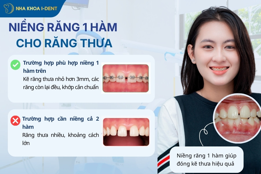 niềng răng một hàm có được không